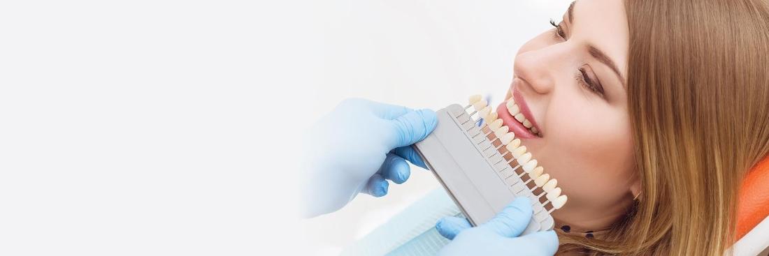 veneers in missoula mt | nelson dentistry